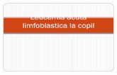 Curs Leucemia Acuta Limfoblastica
