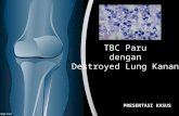 TB Dengan Destroyed Lung