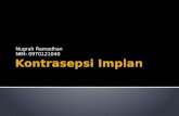 Kontrasepsi Implant