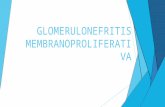 GLOMERULONEFRITIS MEMBRANOPROLIFERATIVA