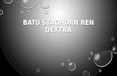 Batu Staghorn Ren Dextra
