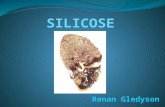 Dds Silicose