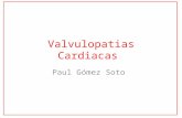 Valvulopatias Cardiacas