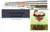 Policitemia neonatal1