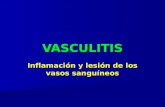 Vasculitis PowerNUEVO