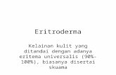 Eritroderma Tata