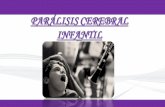 Paralisis Cerebral Infantil Aep . Reahilitacion Expo