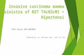Invasive carcinoma mamma sinistra of NST T4c.pptx