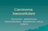 Carcinoma  basocellulareok.ppt