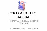 Pericarditis Aguda 11X1