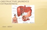 Obstructive Jaundice Extrahepaticc