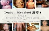Topic : Measles ( 麻疹 ) Group 5: Silvia Pun 4L (27) Annie Leung 4L(21) Kitty Cheng 4M(5) Selina Wen 4S(30)