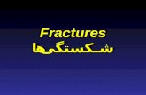 Fractures شکستگی ها. تعریف یک شکستگی ممکن است سبب جدا شدگی کامل در طول استخوان (Continuty) یا ممکن است سبب جدا