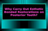 Why Carry Out Esthetic Bonded Restorations on Posterior Teeth?