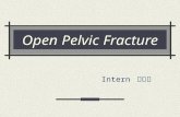 Open Pelvic Fracture Intern 蕭福慶. Brief History 42 y/o female, denied systemic disease Pedestrian hit by car on 94.12.9 Lower limbs numbness, back pain.
