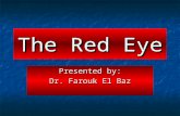 The Red Eye Presented by: Dr. Farouk El Baz. ان العين عادة يجب ان تكون بيضاء صافية لا يشوبها أي احمرار. و في الواقع فإن الجزء