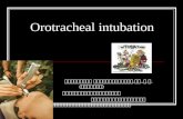 Orotracheal intubation เพชรรัตน์ วิสุทธิเมธีกร, พบ., ว. ว. ( วิสัญญี ) ภาควิชาวิสัญญีวิทยา