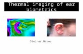 Thermal imaging of ear biometrics Steinar Watne. Outline – Introduction to biometrics – Ear as biometric – Research questions – Experiment – Pre-processing.