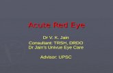 Acute Red Eye Dr V. K. Jain Consultant: TRSH, DRDO Dr Jain’s Univue Eye Care Advisor: UPSC.