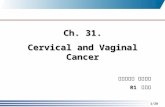 1/28 Ch. 31. Cervical and Vaginal Cancer 부산백병원 산부인과 R1 손영실.