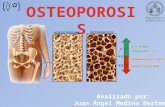 http://saludparati.com/osteoporosis.htm http://www.monografias.com/trabajos11/osteop/osteop.shtml#TIPO http://www.todoosteoporosis.com/osteoporosis_tipos.html.