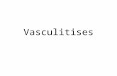 Vasculitises. Outline Basics Small groups Review.