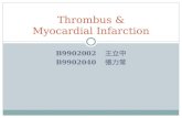 B9902002 王立中 B9902040 張力常 Thrombus & Myocardial Infarction.