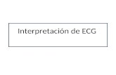 Interpretación de ECG. El latido Importante. Triángulo de Einthoven.