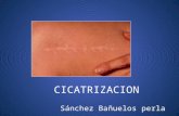 CICATRIZACION Sánchez Bañuelos perla. La cicatrización es la respuesta normal a una lesión. Cicatrización aguda de las heridas: ₋Extensión ₋Tejido ₋Enfermedades.