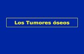 Los Tumores óseos. Tumores óseos Tumores productores de tejido óseo Tumores productores de tejido cartilaginoso Tumor de células gigantes Tumores de la.