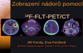 Zobrazení nádorů pomocí  18 F-FLT-PET/CT