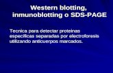 Western blotting,  inmunoblotting o SDS-PAGE