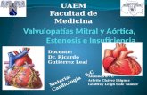 Valvulopatías Mitral y Aórtica,  Estenosis  e Insuficiencia