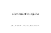Osteomielitis aguda