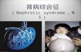 肾病综合征 （ Nephrotic syndrome ， NS ）