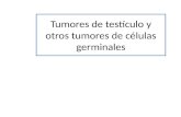 Tumores de testículo y otros tumores de células germinales