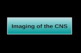 Imaging of the CNS