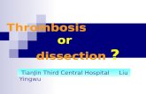 Thrombosis or dissection ?