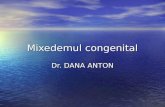 Mixedemul congenital