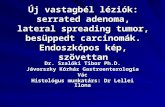 Dr. Szalóki Tibor Ph.D. Jávorszky Kórház Gastroenterologia Vác