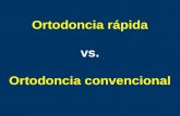 Ortodoncia rápida vs. Ortodoncia convencional