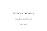 Lithiases urinaires