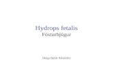 Hydrops fetalis Fósturbjúgur
