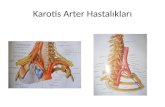 Karotis  Arter Hastalıkları