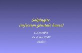 Salpingite  (infection génitale haute)