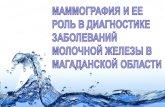 Структура Заболеваемости ЗНО по Магаданской области за 2012год