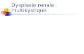 Dysplasie renale multikystique