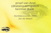 proef van Anel (dilatation&irrigation  lacrimal duct)