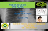 TUBERCULOSIS  (TB PARU)