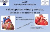 Valvulopatías Mitral y Aórtica,  Estenosis  e Insuficiencia